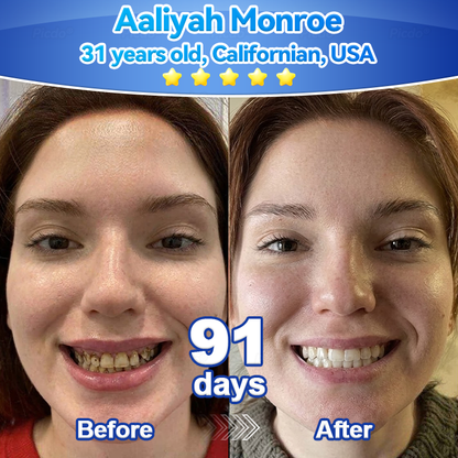 ✨🎇𝑃𝑖𝑐𝑑𝑜® 𝑆𝑡𝑒𝑚 𝐶𝑒𝑙𝑙 𝐺𝑖𝑛𝑔𝑖𝑣𝑎𝑙 𝑅𝑒𝑝𝑎𝑖𝑟 𝑀𝑜𝑢𝑠𝑠𝑒(🦷Promote Tooth Regrowth • Remove Tartar • Strengthen Gums • Deep Clean & Freshen Breath)🍀