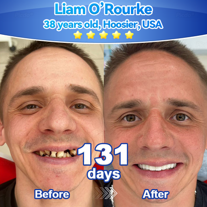 ✨🎇𝑃𝑖𝑐𝑑𝑜® 𝑆𝑡𝑒𝑚 𝐶𝑒𝑙𝑙 𝐺𝑖𝑛𝑔𝑖𝑣𝑎𝑙 𝑅𝑒𝑝𝑎𝑖𝑟 𝑀𝑜𝑢𝑠𝑠𝑒(🦷Promote Tooth Regrowth • Remove Tartar • Strengthen Gums • Deep Clean & Freshen Breath)🍀