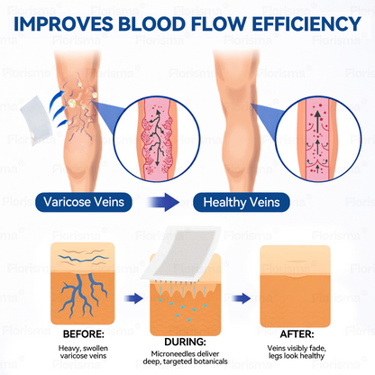 7-Day Visible Results✅𝑭𝑳𝑶𝑹𝑰𝑺𝑴𝑨® 𝐕𝐞𝐢𝐧 𝐂𝐨𝐧𝐭𝐨𝐮𝐫 𝑪𝒍𝒊𝒏𝒊𝒄𝒂𝒍-𝑮𝒓𝒂𝒅𝒆 𝑭𝒐𝒓𝒎𝒖𝒍𝒂 𝑴𝒊𝒄𝒓𝒐𝒏𝒆𝒆𝒅𝒍𝒆 𝑷𝒂𝒕𝒄𝒉(𝑫𝑰𝑶𝑺𝑴𝑰𝑵 & 𝑯𝑬𝑺𝑷𝑬𝑹𝑰𝑫𝑰𝑵)— 𝗔𝗱𝘃𝗮𝗻𝗰𝗲𝗱 𝗛𝗲𝗿𝗯𝗮𝗹 𝗕𝗹𝗲𝗻𝗱 𝗧𝗮𝗿𝗴𝗲𝘁𝘀 𝗦𝗽𝗶𝗱𝗲𝗿 𝗩𝗲𝗶𝗻𝘀 & 𝗥𝗲𝗹𝗶𝗲𝘃𝗲𝘀 𝗛𝗲𝗮𝘃𝘆, 𝗧𝗶𝗿𝗲𝗱 𝗟𝗲𝗴𝘀🍁