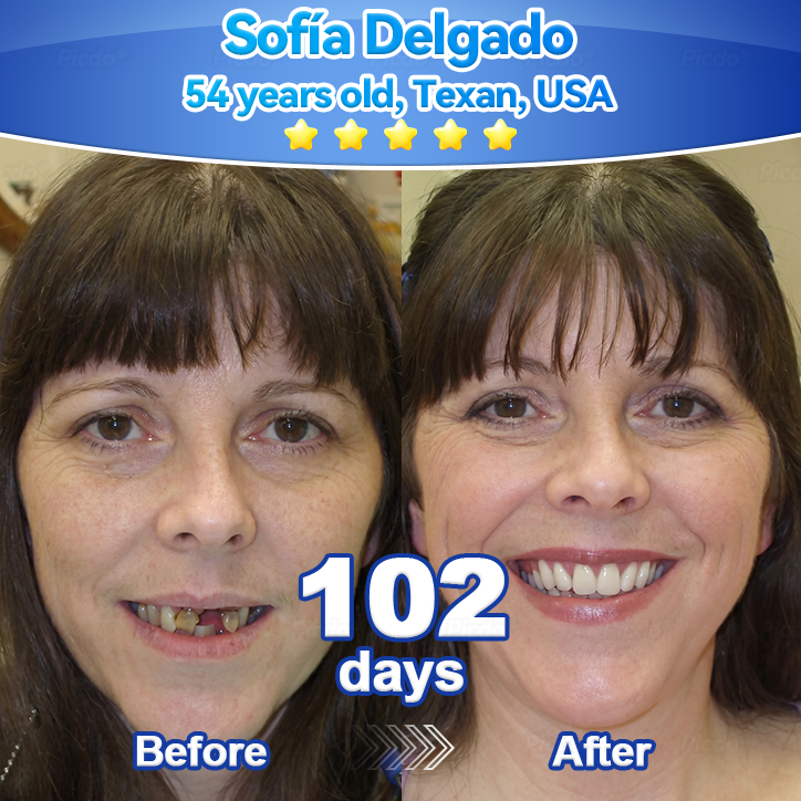 ✨🎇𝑃𝑖𝑐𝑑𝑜® 𝑆𝑡𝑒𝑚 𝐶𝑒𝑙𝑙 𝐺𝑖𝑛𝑔𝑖𝑣𝑎𝑙 𝑅𝑒𝑝𝑎𝑖𝑟 𝑀𝑜𝑢𝑠𝑠𝑒(🦷Promote Tooth Regrowth • Remove Tartar • Strengthen Gums • Deep Clean & Freshen Breath)🍀