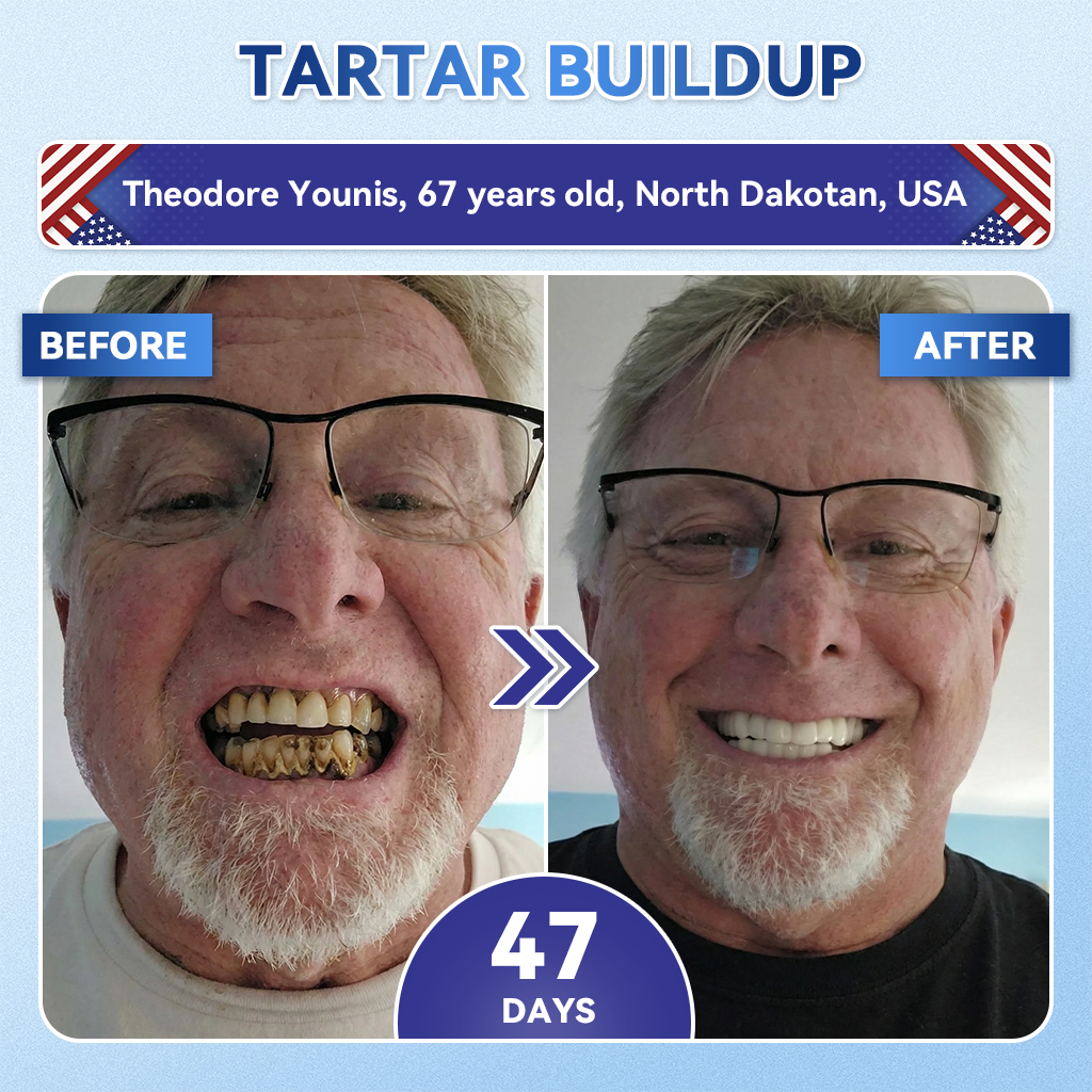 𝐆𝐥𝐢𝐦𝐦𝐞𝐫𝐥𝐲® 𝐓𝐢𝐝𝐞𝐠𝐥𝐮𝐬𝐢𝐛 𝐓𝐨𝐨𝐭𝐡 & 𝐆𝐮𝐦 𝐑𝐞𝐩𝐚𝐢𝐫 𝐌𝐢𝐜𝐫𝐨𝐧𝐞𝐞𝐝𝐥𝐞 𝐏𝐚𝐭𝐜𝐡  | 𝐀𝐝𝐯𝐚𝐧𝐜𝐞𝐝 𝐒𝐭𝐞𝐦-𝐂𝐞𝐥𝐥 𝐀𝐜𝐭𝐢𝐯𝐚𝐭𝐢𝐨𝐧 𝐓𝐞𝐞𝐭𝐡 𝐒𝐭𝐫𝐢𝐩𝐬(🦷𝐑𝐞𝐛𝐮𝐢𝐥𝐝 𝐄𝐧𝐚𝐦𝐞𝐥 & 𝐃𝐞𝐧𝐭𝐢𝐧 • 𝐒𝐭𝐫𝐞𝐧𝐠𝐭𝐡𝐞𝐧 𝐆𝐮𝐦𝐬 • 𝐄𝐫𝐚𝐝𝐢𝐜𝐚𝐭𝐞 𝐓𝐚𝐫𝐭𝐚𝐫 & 𝐎𝐝𝐨𝐫 • 𝐒𝐭𝐨𝐩 𝐓𝐨𝐨𝐭𝐡 𝐒𝐞𝐧𝐬𝐢𝐭𝐢𝐯𝐢𝐭𝐲) 🍁