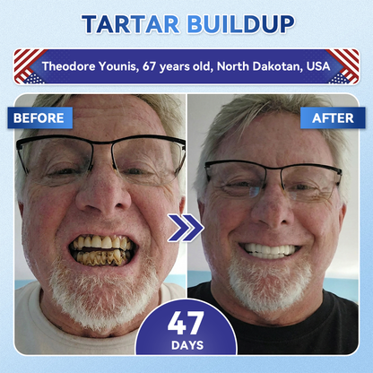 𝐆𝐥𝐢𝐦𝐦𝐞𝐫𝐥𝐲® 𝐓𝐢𝐝𝐞𝐠𝐥𝐮𝐬𝐢𝐛 𝐓𝐨𝐨𝐭𝐡 & 𝐆𝐮𝐦 𝐑𝐞𝐩𝐚𝐢𝐫 𝐌𝐢𝐜𝐫𝐨𝐧𝐞𝐞𝐝𝐥𝐞 𝐏𝐚𝐭𝐜𝐡  | 𝐀𝐝𝐯𝐚𝐧𝐜𝐞𝐝 𝐒𝐭𝐞𝐦-𝐂𝐞𝐥𝐥 𝐀𝐜𝐭𝐢𝐯𝐚𝐭𝐢𝐨𝐧 𝐓𝐞𝐞𝐭𝐡 𝐒𝐭𝐫𝐢𝐩𝐬(🦷𝐑𝐞𝐛𝐮𝐢𝐥𝐝 𝐄𝐧𝐚𝐦𝐞𝐥 & 𝐃𝐞𝐧𝐭𝐢𝐧 • 𝐒𝐭𝐫𝐞𝐧𝐠𝐭𝐡𝐞𝐧 𝐆𝐮𝐦𝐬 • 𝐄𝐫𝐚𝐝𝐢𝐜𝐚𝐭𝐞 𝐓𝐚𝐫𝐭𝐚𝐫 & 𝐎𝐝𝐨𝐫 • 𝐒𝐭𝐨𝐩 𝐓𝐨𝐨𝐭𝐡 𝐒𝐞𝐧𝐬𝐢𝐭𝐢𝐯𝐢𝐭𝐲) 🍁