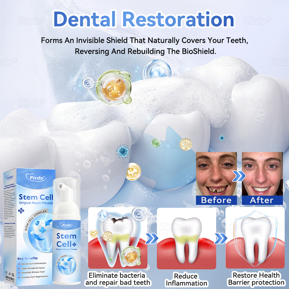 ✨🎇𝑃𝑖𝑐𝑑𝑜® 𝑆𝑡𝑒𝑚 𝐶𝑒𝑙𝑙 𝐺𝑖𝑛𝑔𝑖𝑣𝑎𝑙 𝑅𝑒𝑝𝑎𝑖𝑟 𝑀𝑜𝑢𝑠𝑠𝑒(🦷Promote Tooth Regrowth • Remove Tartar • Strengthen Gums • Deep Clean & Freshen Breath)🍀