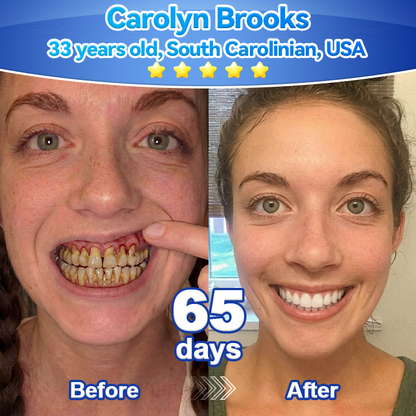 ✨🎇𝑃𝑖𝑐𝑑𝑜® 𝑆𝑡𝑒𝑚 𝐶𝑒𝑙𝑙 𝐺𝑖𝑛𝑔𝑖𝑣𝑎𝑙 𝑅𝑒𝑝𝑎𝑖𝑟 𝑀𝑜𝑢𝑠𝑠𝑒(🦷Promote Tooth Regrowth • Remove Tartar • Strengthen Gums • Deep Clean & Freshen Breath)🍀
