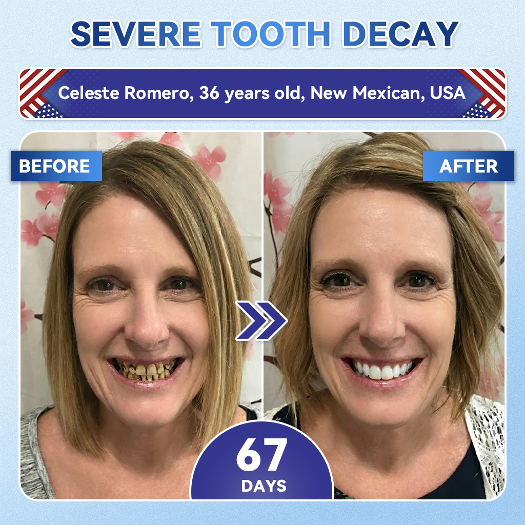 𝐆𝐥𝐢𝐦𝐦𝐞𝐫𝐥𝐲® 𝐓𝐢𝐝𝐞𝐠𝐥𝐮𝐬𝐢𝐛 𝐓𝐨𝐨𝐭𝐡 & 𝐆𝐮𝐦 𝐑𝐞𝐩𝐚𝐢𝐫 𝐌𝐢𝐜𝐫𝐨𝐧𝐞𝐞𝐝𝐥𝐞 𝐏𝐚𝐭𝐜𝐡  | 𝐀𝐝𝐯𝐚𝐧𝐜𝐞𝐝 𝐒𝐭𝐞𝐦-𝐂𝐞𝐥𝐥 𝐀𝐜𝐭𝐢𝐯𝐚𝐭𝐢𝐨𝐧 𝐓𝐞𝐞𝐭𝐡 𝐒𝐭𝐫𝐢𝐩𝐬(🦷𝐑𝐞𝐛𝐮𝐢𝐥𝐝 𝐄𝐧𝐚𝐦𝐞𝐥 & 𝐃𝐞𝐧𝐭𝐢𝐧 • 𝐒𝐭𝐫𝐞𝐧𝐠𝐭𝐡𝐞𝐧 𝐆𝐮𝐦𝐬 • 𝐄𝐫𝐚𝐝𝐢𝐜𝐚𝐭𝐞 𝐓𝐚𝐫𝐭𝐚𝐫 & 𝐎𝐝𝐨𝐫 • 𝐒𝐭𝐨𝐩 𝐓𝐨𝐨𝐭𝐡 𝐒𝐞𝐧𝐬𝐢𝐭𝐢𝐯𝐢𝐭𝐲) 🍁