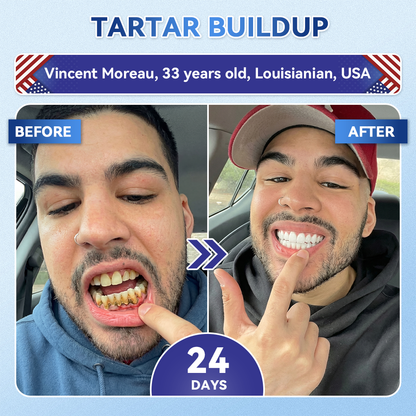 𝐆𝐥𝐢𝐦𝐦𝐞𝐫𝐥𝐲® 𝐓𝐢𝐝𝐞𝐠𝐥𝐮𝐬𝐢𝐛 𝐓𝐨𝐨𝐭𝐡 & 𝐆𝐮𝐦 𝐑𝐞𝐩𝐚𝐢𝐫 𝐌𝐢𝐜𝐫𝐨𝐧𝐞𝐞𝐝𝐥𝐞 𝐏𝐚𝐭𝐜𝐡  | 𝐀𝐝𝐯𝐚𝐧𝐜𝐞𝐝 𝐒𝐭𝐞𝐦-𝐂𝐞𝐥𝐥 𝐀𝐜𝐭𝐢𝐯𝐚𝐭𝐢𝐨𝐧 𝐓𝐞𝐞𝐭𝐡 𝐒𝐭𝐫𝐢𝐩𝐬(🦷𝐑𝐞𝐛𝐮𝐢𝐥𝐝 𝐄𝐧𝐚𝐦𝐞𝐥 & 𝐃𝐞𝐧𝐭𝐢𝐧 • 𝐒𝐭𝐫𝐞𝐧𝐠𝐭𝐡𝐞𝐧 𝐆𝐮𝐦𝐬 • 𝐄𝐫𝐚𝐝𝐢𝐜𝐚𝐭𝐞 𝐓𝐚𝐫𝐭𝐚𝐫 & 𝐎𝐝𝐨𝐫 • 𝐒𝐭𝐨𝐩 𝐓𝐨𝐨𝐭𝐡 𝐒𝐞𝐧𝐬𝐢𝐭𝐢𝐯𝐢𝐭𝐲) 🍒