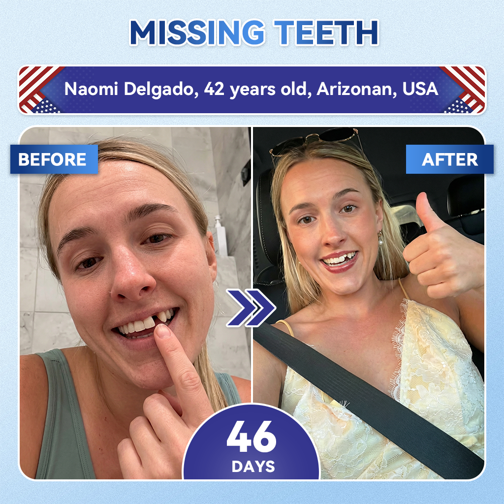 🦷𝐆𝐥𝐢𝐦𝐦𝐞𝐫𝐥𝐲® 𝐓𝐢𝐝𝐞𝐠𝐥𝐮𝐬𝐢𝐛 𝐓𝐨𝐨𝐭𝐡 & 𝐆𝐮𝐦 𝐑𝐞𝐩𝐚𝐢𝐫 𝐌𝐢𝐜𝐫𝐨𝐧𝐞𝐞𝐝𝐥𝐞 𝐏𝐚𝐭𝐜𝐡  | 𝐀𝐝𝐯𝐚𝐧𝐜𝐞𝐝 𝐒𝐭𝐞𝐦-𝐂𝐞𝐥𝐥 𝐀𝐜𝐭𝐢𝐯𝐚𝐭𝐢𝐨𝐧 𝐓𝐞𝐞𝐭𝐡 𝐒𝐭𝐫𝐢𝐩𝐬(🦷𝐑𝐞𝐛𝐮𝐢𝐥𝐝 𝐄𝐧𝐚𝐦𝐞𝐥 & 𝐃𝐞𝐧𝐭𝐢𝐧 • 𝐒𝐭𝐫𝐞𝐧𝐠𝐭𝐡𝐞𝐧 𝐆𝐮𝐦𝐬 • 𝐄𝐫𝐚𝐝𝐢𝐜𝐚𝐭𝐞 𝐓𝐚𝐫𝐭𝐚𝐫 & 𝐎𝐝𝐨𝐫 • 𝐒𝐭𝐨𝐩 𝐓𝐨𝐨𝐭𝐡 𝐒𝐞𝐧𝐬𝐢𝐭𝐢𝐯𝐢𝐭𝐲) 3.0