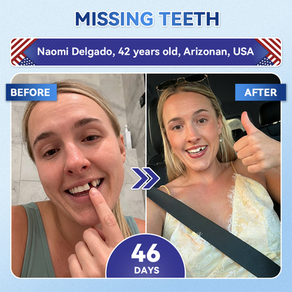 🦷𝐆𝐥𝐢𝐦𝐦𝐞𝐫𝐥𝐲® 𝐓𝐢𝐝𝐞𝐠𝐥𝐮𝐬𝐢𝐛 𝐓𝐨𝐨𝐭𝐡 & 𝐆𝐮𝐦 𝐑𝐞𝐩𝐚𝐢𝐫 𝐌𝐢𝐜𝐫𝐨𝐧𝐞𝐞𝐝𝐥𝐞 𝐏𝐚𝐭𝐜𝐡  | 𝐀𝐝𝐯𝐚𝐧𝐜𝐞𝐝 𝐒𝐭𝐞𝐦-𝐂𝐞𝐥𝐥 𝐀𝐜𝐭𝐢𝐯𝐚𝐭𝐢𝐨𝐧 𝐓𝐞𝐞𝐭𝐡 𝐒𝐭𝐫𝐢𝐩𝐬(🦷𝐑𝐞𝐛𝐮𝐢𝐥𝐝 𝐄𝐧𝐚𝐦𝐞𝐥 & 𝐃𝐞𝐧𝐭𝐢𝐧 • 𝐒𝐭𝐫𝐞𝐧𝐠𝐭𝐡𝐞𝐧 𝐆𝐮𝐦𝐬 • 𝐄𝐫𝐚𝐝𝐢𝐜𝐚𝐭𝐞 𝐓𝐚𝐫𝐭𝐚𝐫 & 𝐎𝐝𝐨𝐫 • 𝐒𝐭𝐨𝐩 𝐓𝐨𝐨𝐭𝐡 𝐒𝐞𝐧𝐬𝐢𝐭𝐢𝐯𝐢𝐭𝐲) 3.0