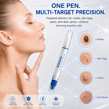 𝗩𝘀𝗼𝐱𝐚® 𝟤-𝗶𝗻-𝟭 𝗪𝗮𝗋𝗍 & 𝖬𝗈𝑙𝑒 𝐒𝐨𝐥𝐮𝘁𝗶𝗼𝗻