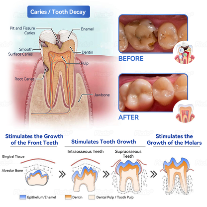 ✨🎇𝑃𝑖𝑐𝑑𝑜® 𝑆𝑡𝑒𝑚 𝐶𝑒𝑙𝑙 𝐺𝑖𝑛𝑔𝑖𝑣𝑎𝑙 𝑅𝑒𝑝𝑎𝑖𝑟 𝑀𝑜𝑢𝑠𝑠𝑒(🦷Promote Tooth Regrowth • Remove Tartar • Strengthen Gums • Deep Clean & Freshen Breath)🍀